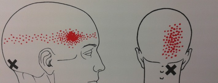 whiplash massage Amsterdam